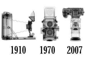 Эволюция камер, запечетлённая в серии рентгеновских снимков